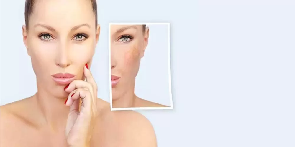 Remove-Any-Blemishes-Or-Imperfections